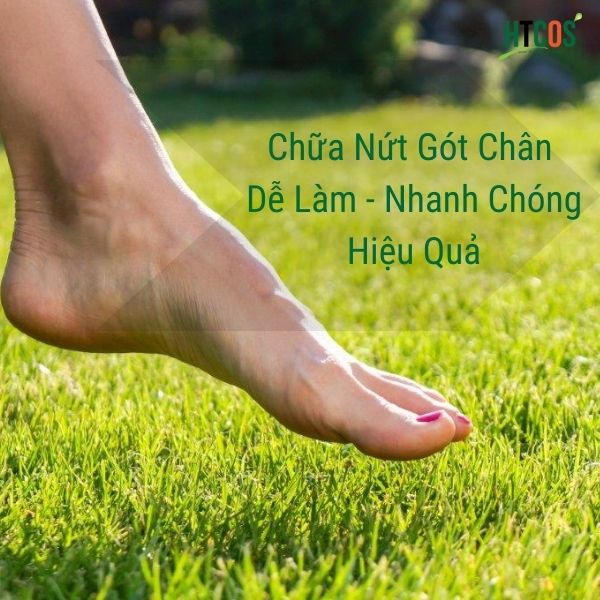 Cách Trị Nứt Gót Chân Dễ Làm